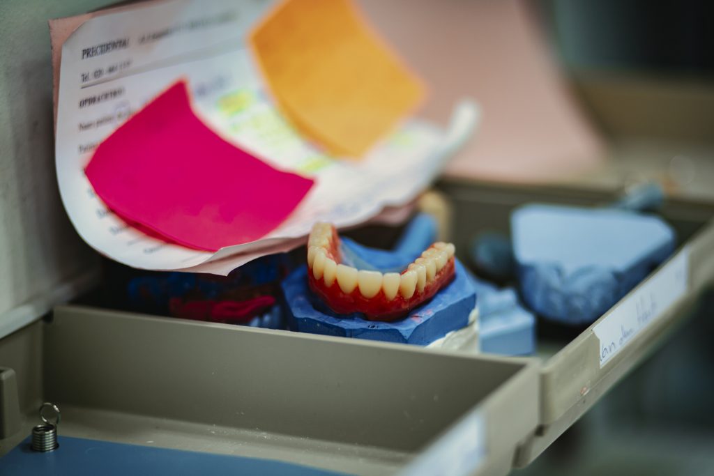 Eventfotografie: Gebitsprothese in blauwe mal, met notities en documenten. Tandtechnisch werk. Joep van Drunen Photography